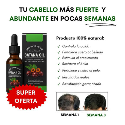✨🍀Aceite Batana ORIGINAL: El Secreto Ancestral para Prevenir la Caída del Cabello y Estimular el Crecimiento ✔ -Últimas 7 Unidades 🔥