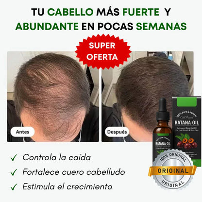 ✨🍀Aceite Batana ORIGINAL: El Secreto Ancestral para Prevenir la Caída del Cabello y Estimular el Crecimiento ✔ -Últimas 7 Unidades 🔥