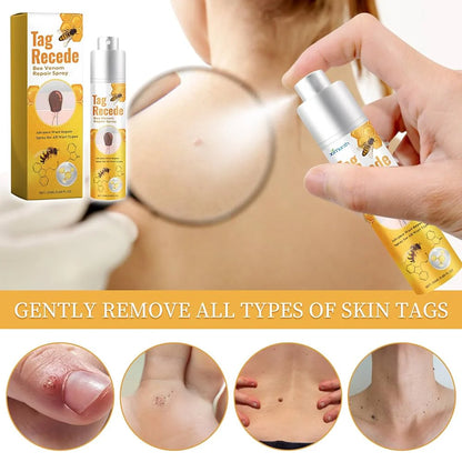 Eliminador de Verrugas Tag Recede® Original - Últimas 7 Unidades 🔥