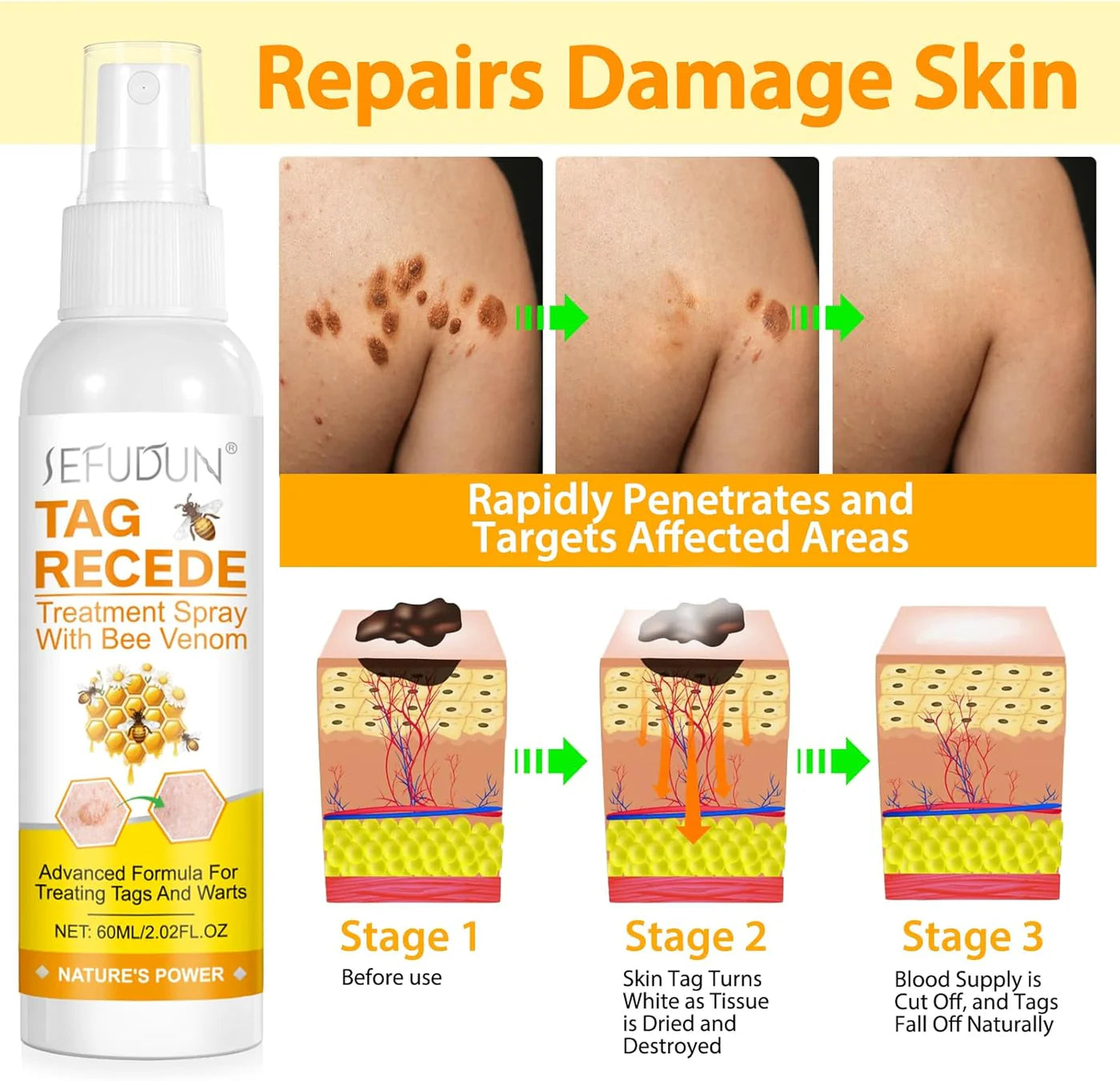 Eliminador de Verrugas Tag Recede® Original - Últimas 7 Unidades 🔥