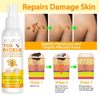 Eliminador de Verrugas Tag Recede® Original - Últimas 7 Unidades 🔥