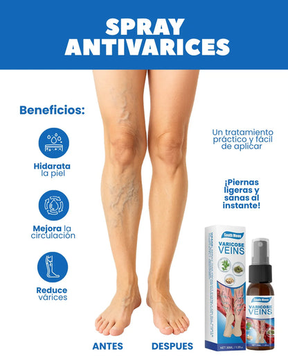 SPRAY ANTI VARICES - ADIOS VENAS (30 ml) -Últimas 7 Unidades 🔥